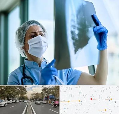 جراح سرطان ریه در دولت 