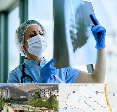 جراح سرطان ریه در شهر زیبا 