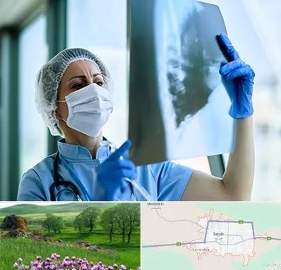 جراح سرطان ریه در سراب