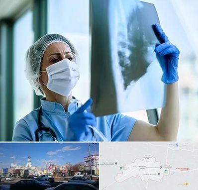 جراح سرطان ریه در ماهدشت کرج 