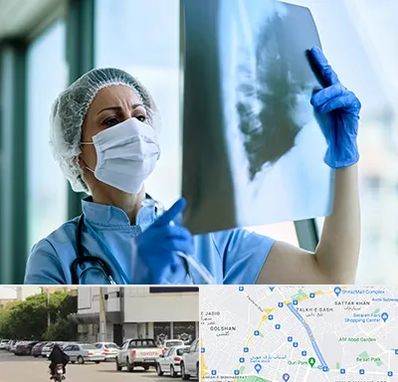 جراح سرطان ریه در قدوسی شرقی شیراز 