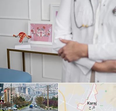 دکتر سرطان تخمدان در گوهردشت کرج 