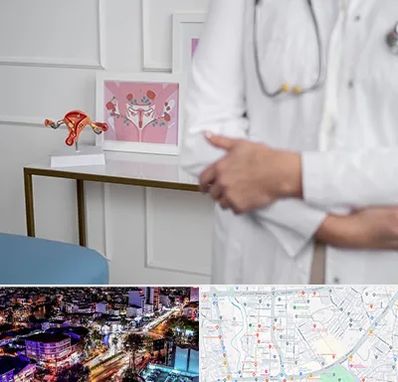 دکتر سرطان تخمدان در منظریه رشت 