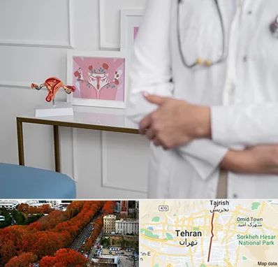 دکتر سرطان تخمدان در ولیعصر 