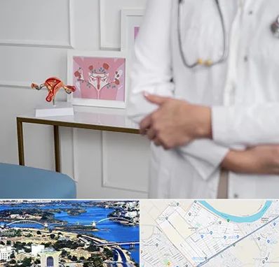 دکتر سرطان تخمدان در کوروش اهواز 