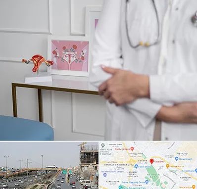 دکتر سرطان تخمدان در بلوار توس مشهد 