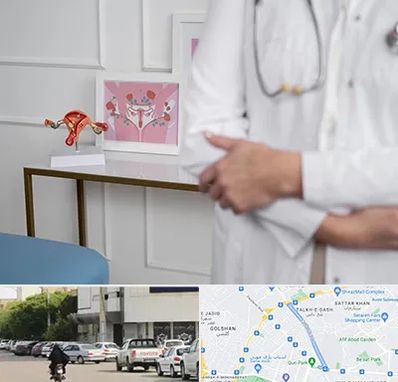 دکتر سرطان تخمدان در قدوسی شرقی شیراز 