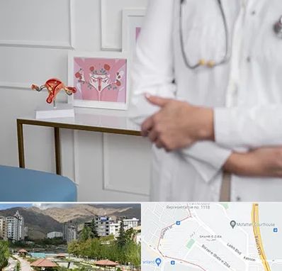 دکتر سرطان تخمدان در شهر زیبا 