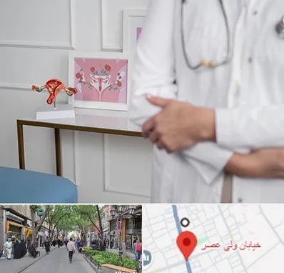 دکتر سرطان تخمدان در ولیعصر شهریار