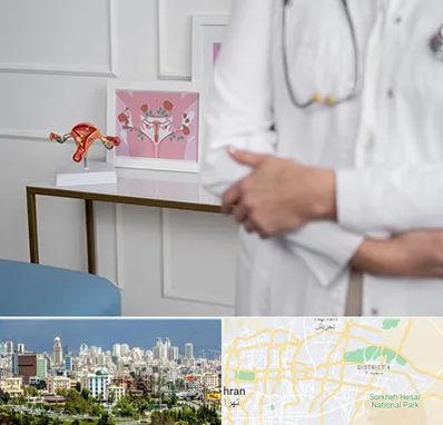 دکتر سرطان تخمدان در شرق تهران 