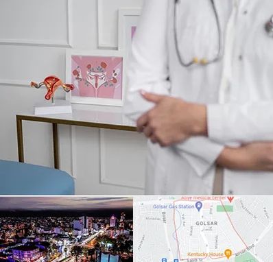 دکتر سرطان تخمدان در گلسار رشت 