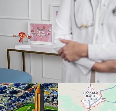 دکتر سرطان تخمدان در گنبد کاووس