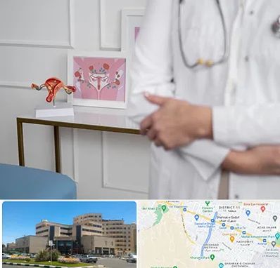 دکتر سرطان تخمدان در صیاد شیرازی مشهد 