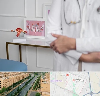 دکتر سرطان تخمدان در فاز سه اندیشه