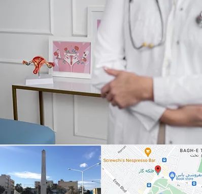 دکتر سرطان تخمدان در فلکه گاز شیراز 