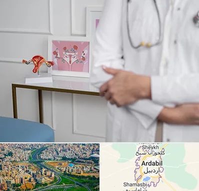 دکتر سرطان تخمدان در اردبیل