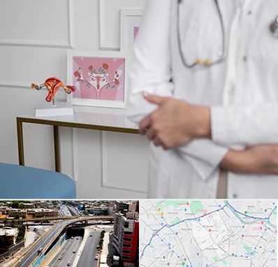 دکتر سرطان تخمدان در ستارخان شیراز 