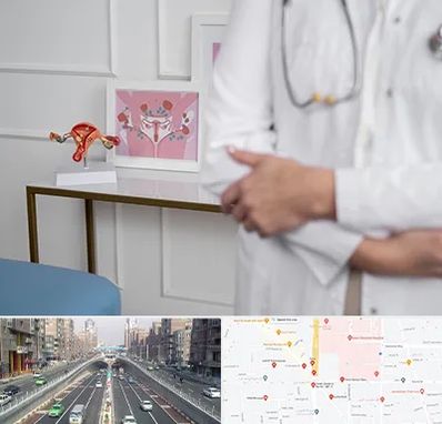 دکتر سرطان تخمدان در توحید 