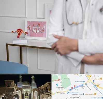 دکتر سرطان تخمدان در زرگری شیراز 