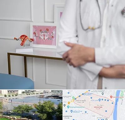 دکتر سرطان تخمدان در گلستان اهواز 