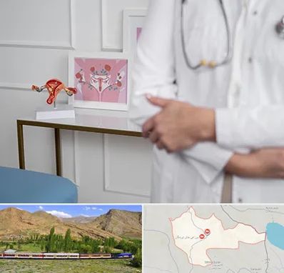 دکتر سرطان تخمدان در خاش