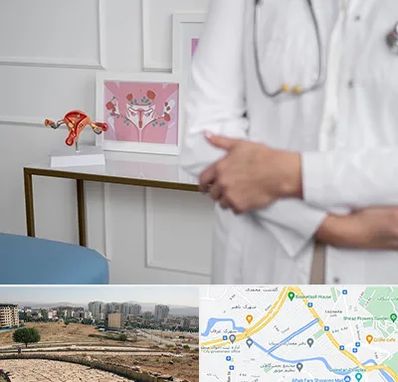 دکتر سرطان تخمدان در کوی وحدت شیراز 