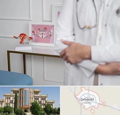 دکتر سرطان تخمدان در دهدشت
