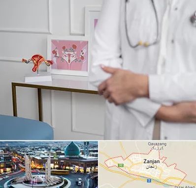 دکتر سرطان تخمدان در زنجان