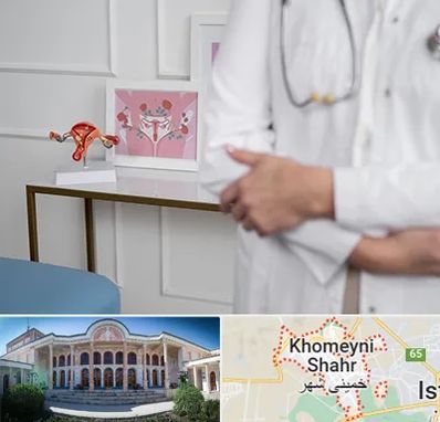 دکتر سرطان تخمدان در خمینی شهر