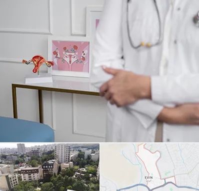 دکتر سرطان تخمدان در اوین
