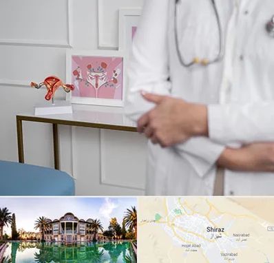 دکتر سرطان تخمدان در شیراز