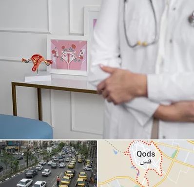 دکتر سرطان تخمدان در شهر قدس