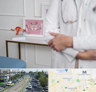 دکتر سرطان تخمدان در جنوب تهران 