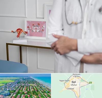دکتر سرطان تخمدان در ساری