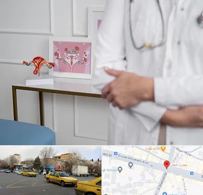 دکتر سرطان تخمدان در شهناز تبریز