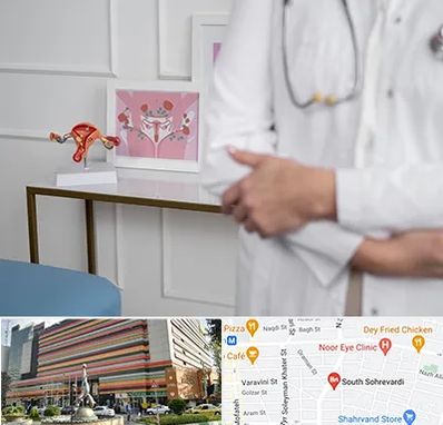 دکتر سرطان تخمدان در سهروردی 