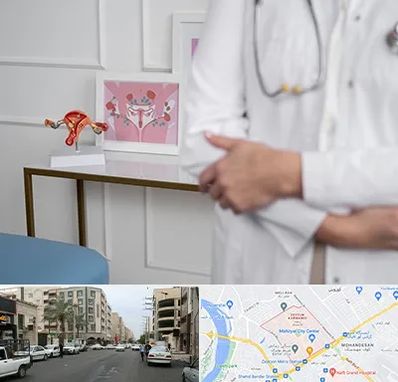 دکتر سرطان تخمدان در زیتون کارمندی اهواز 