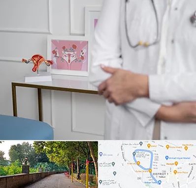 دکتر سرطان تخمدان در فلکه گاز رشت 