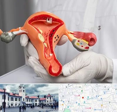 دکتر سرطان رحم در میدان شهرداری رشت 