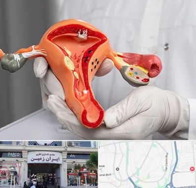 دکتر سرطان رحم در ایران زمین