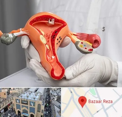 دکتر سرطان رحم در بازار رضا مشهد