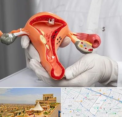 دکتر سرطان رحم در هاشمیه مشهد 