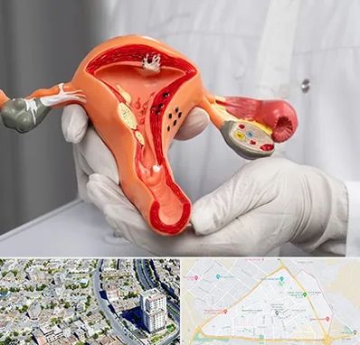 دکتر سرطان رحم در قاسم آباد مشهد 