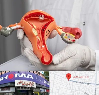 دکتر سرطان رحم در امین حضور