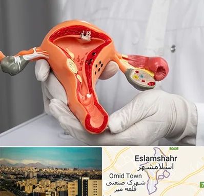 دکتر سرطان رحم در اسلامشهر