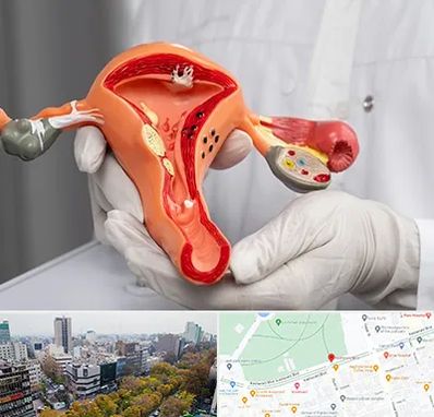 دکتر سرطان رحم در بلوار کشاورز 