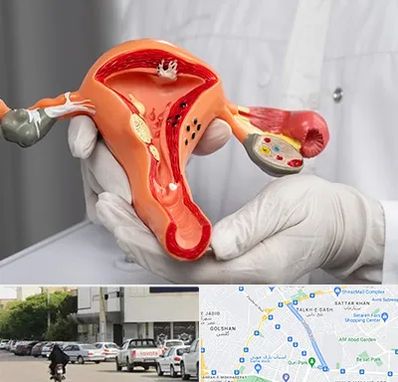 دکتر سرطان رحم در قدوسی شرقی شیراز 