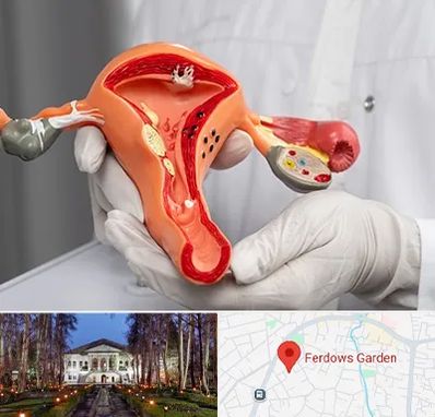 دکتر سرطان رحم در باغ فردوس