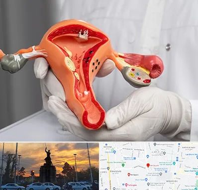 دکتر سرطان رحم در میدان حر 