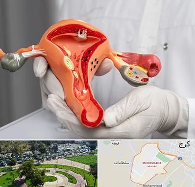 دکتر سرطان رحم در مهرشهر کرج 